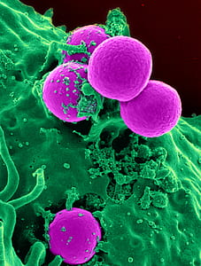 purple and green micro bacteria