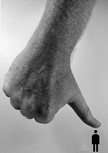 grayscale photo of human thumb