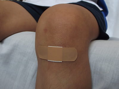 person wearing black shorts with band aid
