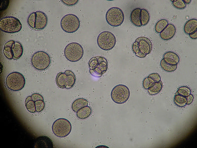 microscopic photo of bacterias