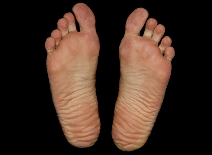 person's foot sole
