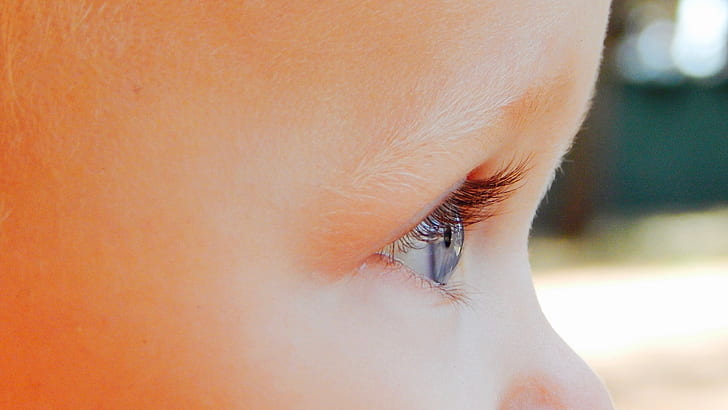 toddler's right eye