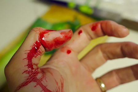 wound hand with blood